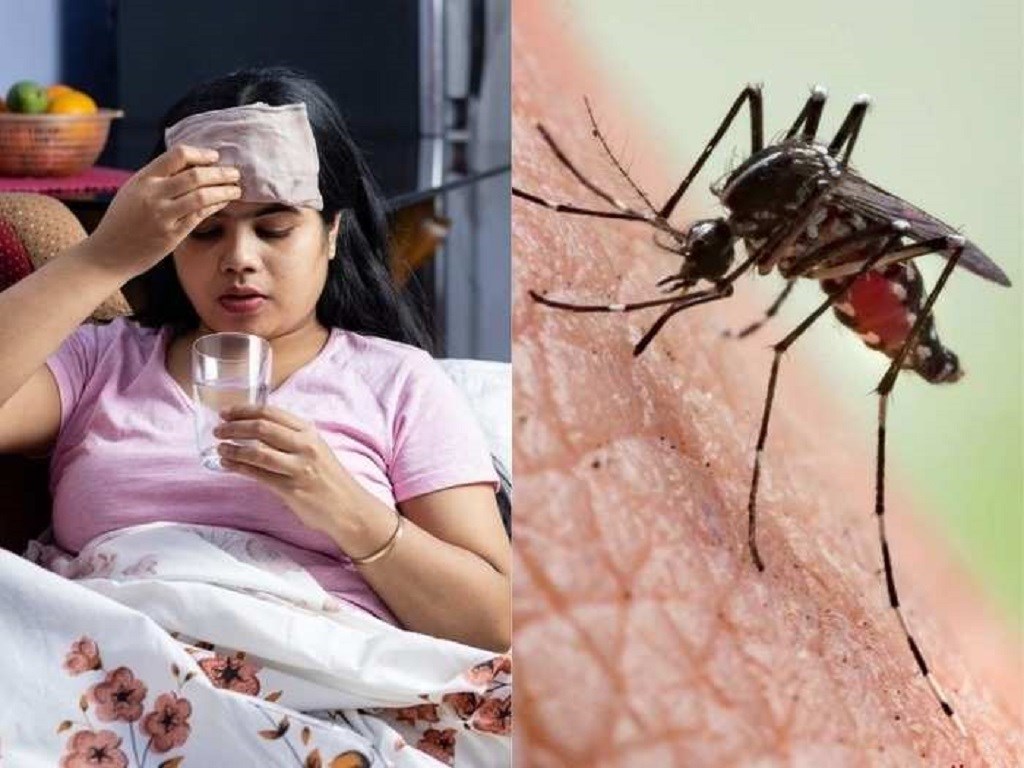Dengue Viral
